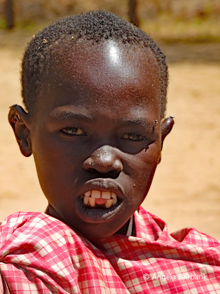 Boya girl shoing teeth extraction