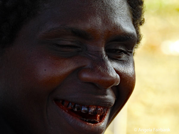 man with stained teeth